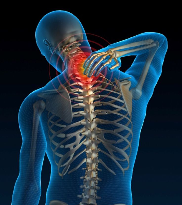 Three Ligaments in My Neck that were Damaged by My Forward Head Posture?