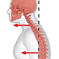 How does Forward Head Posture Impact Your C1 Vertebrae