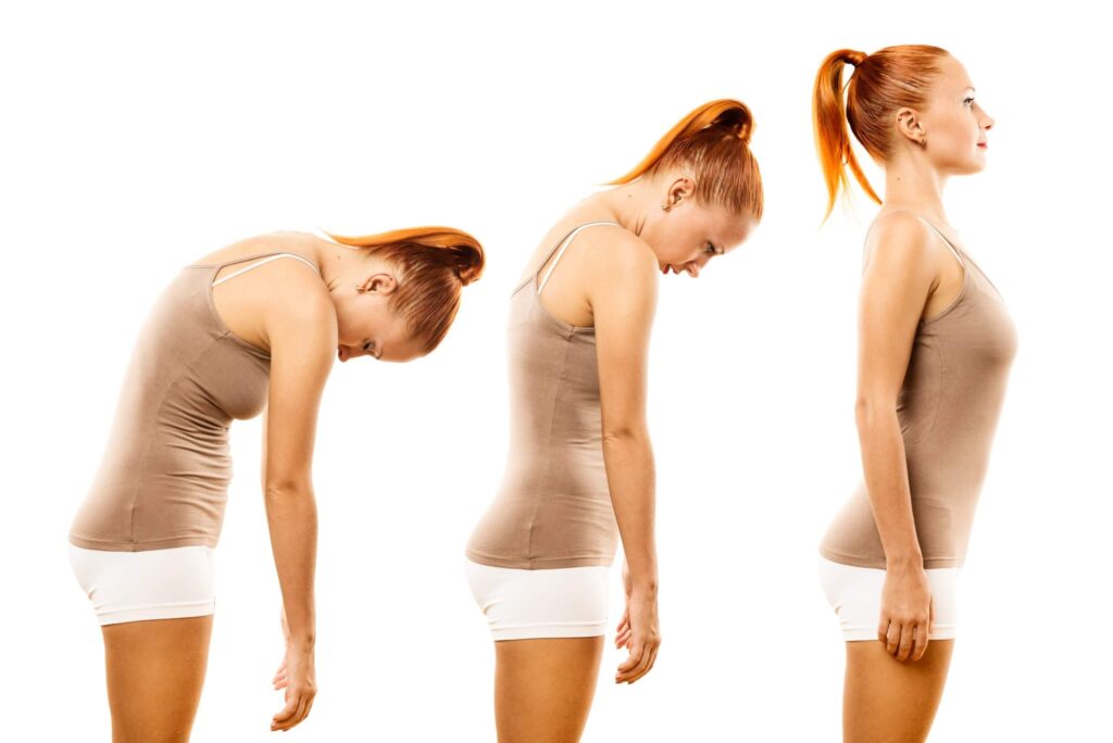 How My Bad Neck Posture Impact My C2 Vertebrae