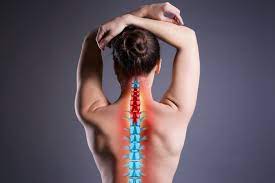 Spinal Fusion for Fixing Bad Neck Posture