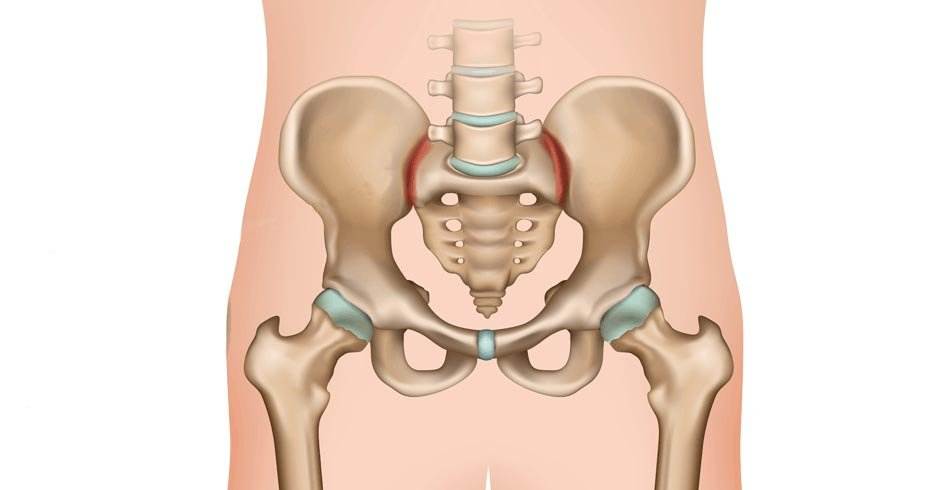 How Curved Neck from Bad Posture Damaged My Ilium