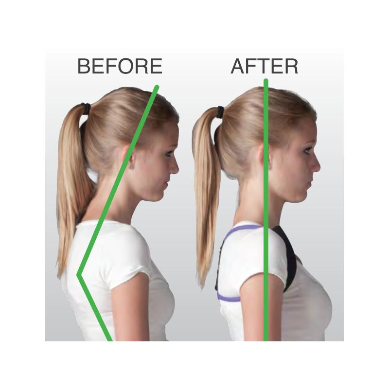 How Posture Correction Bands Align the Neck and Shoulders