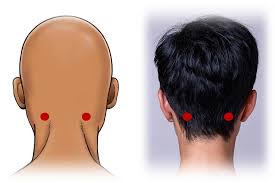 How Acupuncture Relieves Neck Tension for Posture Improvement