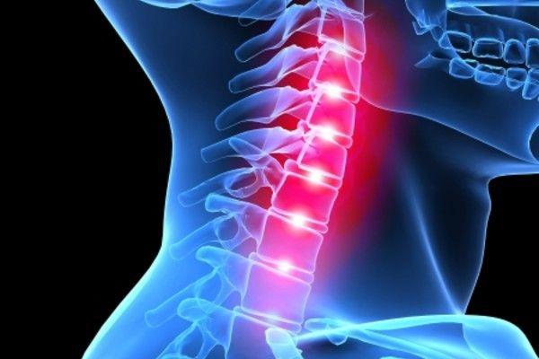 How Cervical Fusion Surgery Stabilizes Neck Alignment