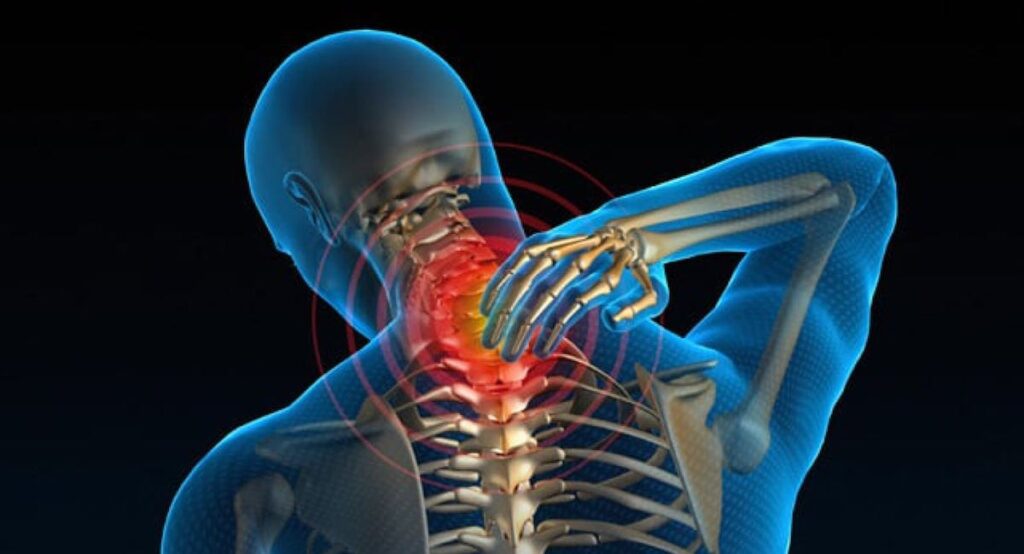 How Poor Neck Posture Strains Your Cervical Muscles