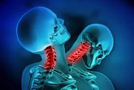 How a Concussion Affects Neck Alignment and Posture