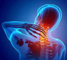 How Neck Misalignment Causes Cervical Disc Issues