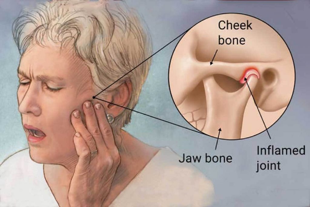 How Military Neck Posture Strains Jaw Muscles