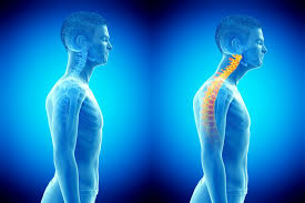 How to Assess Neck Alignment for Forward Head Posture