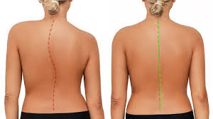 How a Forward-Leaning Neck Increases Strain on Your Lumbar Spine