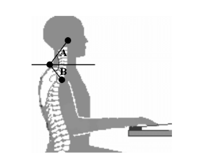 How Posture Trackers Detect Forward Head Posture in Real Time