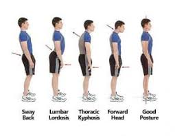 How Posture Correction Techniques Reduce Neck Pain