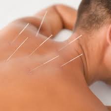 Different Types of Needle Based Therapies for Fixing Nerd Neck