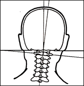 Neck Alignment and Cervical Discs