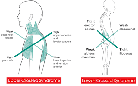 Genetic Factors Behind Inherited Muscle Imbalances