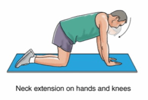 The Impact of Weak Neck Extensors on Posture