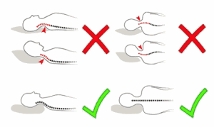 How to Position a Cushion for Forward Head Posture