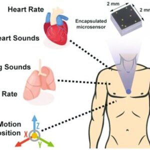 Inertial Measurement Units (IMUs) in Posture Tracking