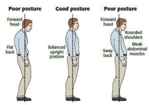 Biomechanical Effects of Poor Posture on the Cervical Spine