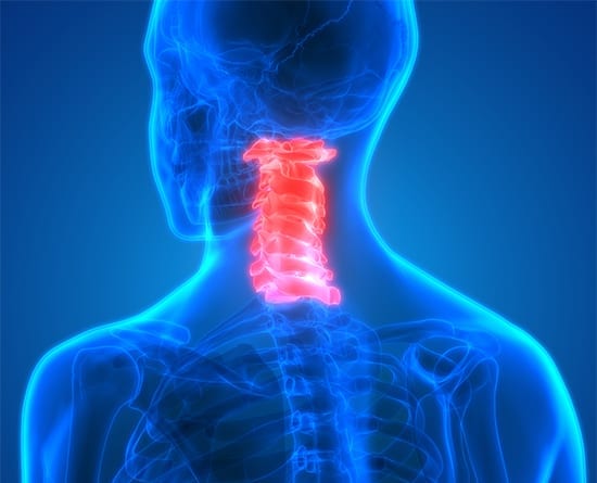 How Anterior Cervical Discectomy and Fusion Improves Neck Posture