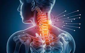 Understanding Cervical Spine Misalignment