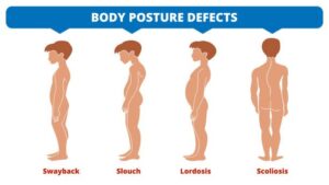 Tools to Enhance Self-Checks for posture assessment