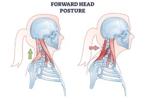 Role of Spinal Curvature in Maintaining Neck Stability