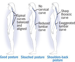 How Forward Neck Posture Affects Spinal Mechanics