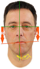 Impact of Military Neck Posture on Jaw Muscles