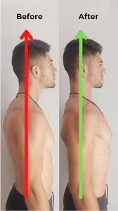 what is bad neck posture