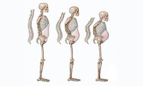 Head Posture Alterations Due to Osteoporosis