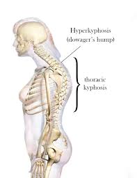 How Genetics Influence Bone Development