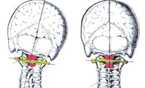 Understanding Postural Analysis and Its Importance