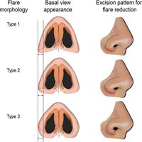 neck Posture and Sinus Pressure
