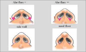 Scientific Evidence Supporting the Impact of Forward Head Tilt on Nostrils