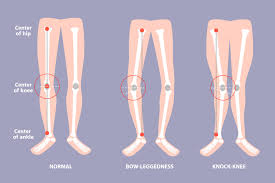 How Forward Head Posture Affects Lower Leg Alignment