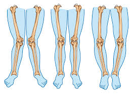 poor neck posture disturbs lower leg alignment