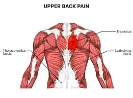 The Effect of Head Weight on Upper Spine Load