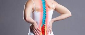 How Cervical Kyphosis impacts Shoulder Blade Stability