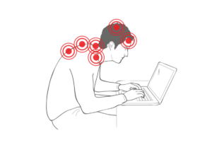 The Biomechanics Behind Device Related Neck Strain