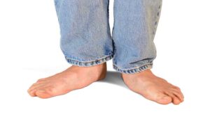 Development of Flat Feet Due to Postural Changes in the neck