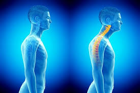 How to Fix Tech Neck with Devices