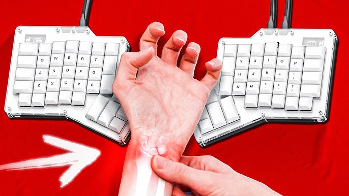 How Ergonomic Keyboards Prevent Bad Posture Neck Forward