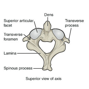 How Did My Forward Head Posture Damage My C2 Vertebrae