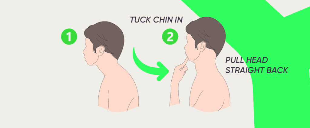 How Chin Tucks Realign the Cervical Spine