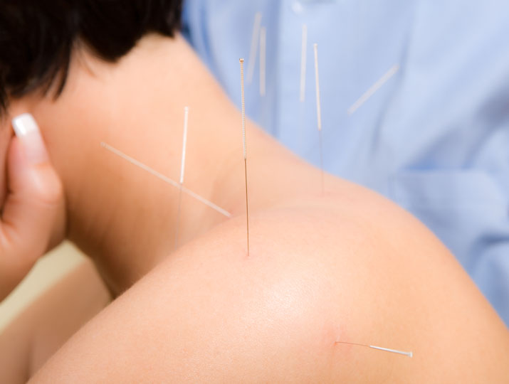 How Acupuncture Reduces Inflammation around the Cervical Vertebrae