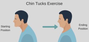 Do Chin Tucks really Change Posture and Pain