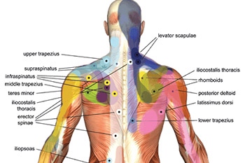 How Trigger Point Therapy Alleviates Neck Strain