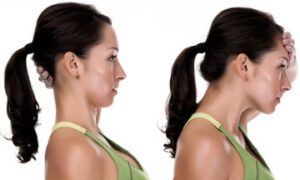 cervical posture correction kinesiology program