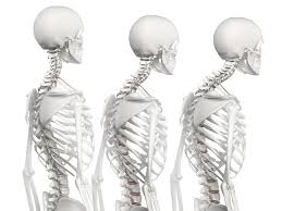 steps to integrate chin tucks into your daily routine to fix poor neck posture